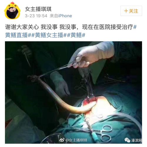 女主播琪琪黄鳝门视频:女主播琪琪因在直播中进行了一场与黄鳝的不可描述行为而走红网络
